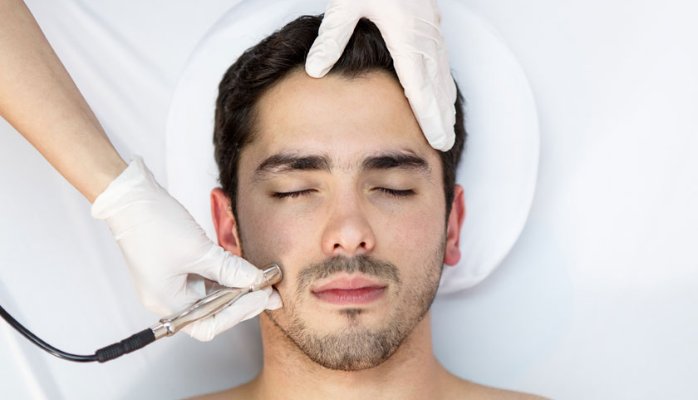 Microdermabrasion at home 